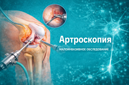 Артроскопия суставов: показания, ход операции и реабилитация