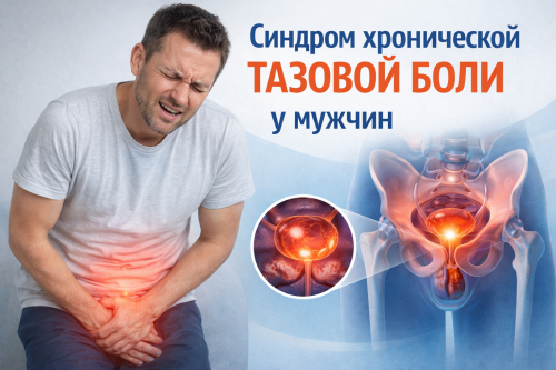 Лечение тазовых болей у мужчин