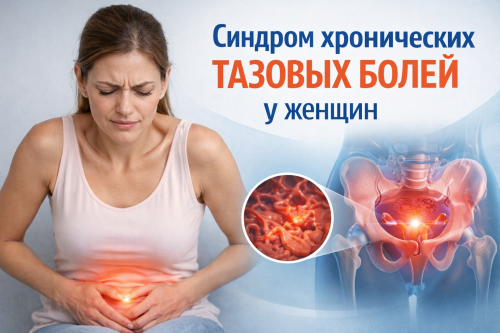 Лечение тазовых болей у женщин