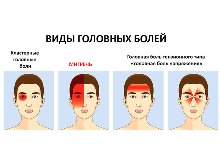 Лечение головной боли и мигрени во Владивостоке