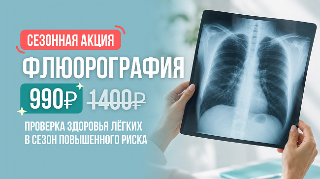 флюорография 990 рублей